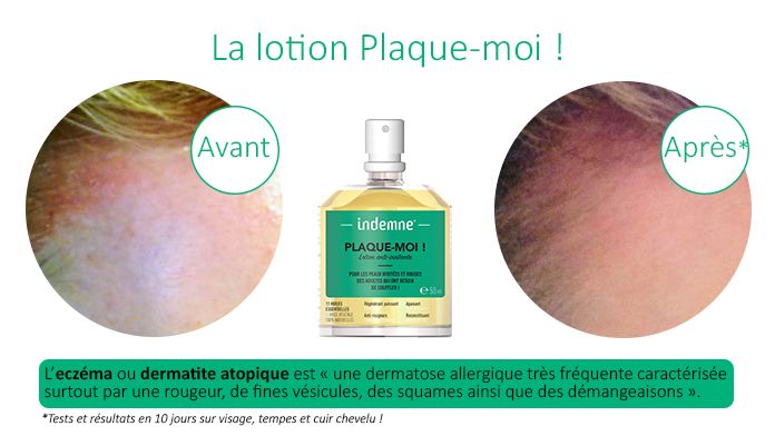 plaque_moi_lotion_preuve