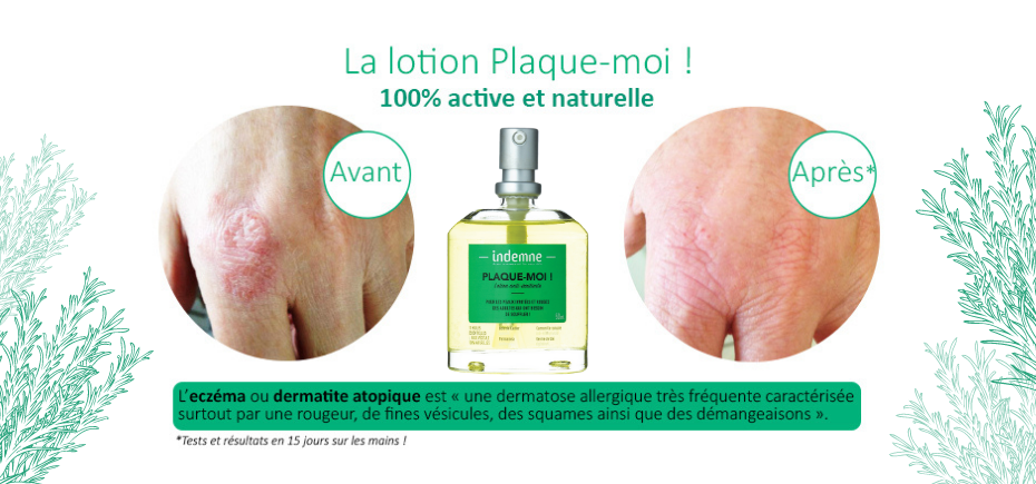 Avant/après résultats lotion réparatrice Plaque-moi !