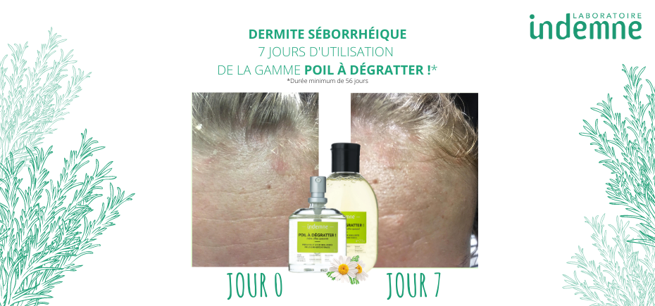 Avant/après résultats dermite séborrhéique gamme Poil à Dégratter !